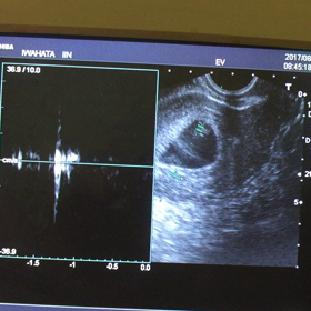 7W2D またもや出血の画像