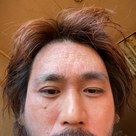 悟空虫操りばれの画像