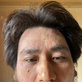 HYDEキムタ犯罪訴えの画像