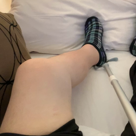 ボツリヌス菌注射の画像