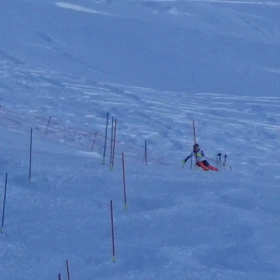 坐骨神経がガビーんとなりましたの画像