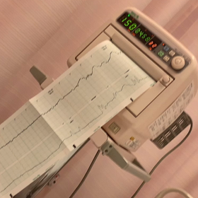 妊娠38週健診の画像