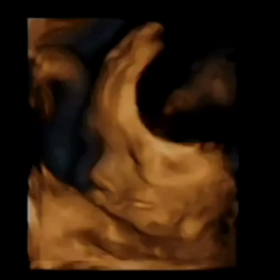 4D全編♡の画像