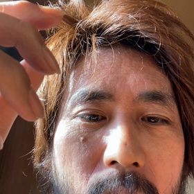 HYDEばれ　清春暴力犯罪の画像