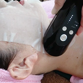 フェイスラインのたるみの画像