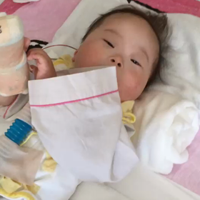 動脈管開存症 入院3日目の画像