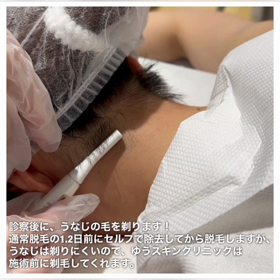 【美容】うなじ脱毛レポートの画像