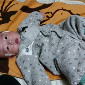 外科からの手術説明☆グレンへ向けての画像