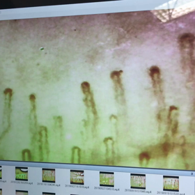 水素ガス吸入の院内勉強会をしましたの画像