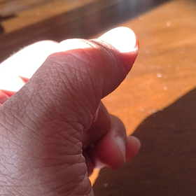 ばね指❗左手中指❗動き出すの画像