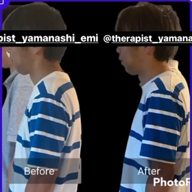 AGOメソッド山梨(^^)猫背の変化の画像