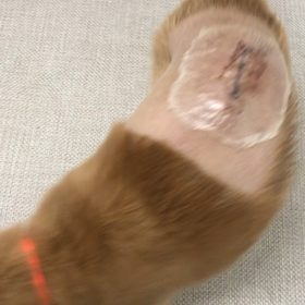 ２０１８年9月15日 術後2日目の画像