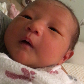 しゃっくりの画像