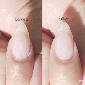 ビットの実力！ネイルマシーンケアの画像