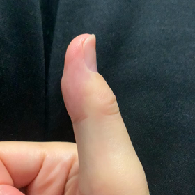 右と左の違いの画像