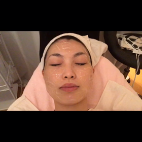 フォトフェイシャル☆の画像