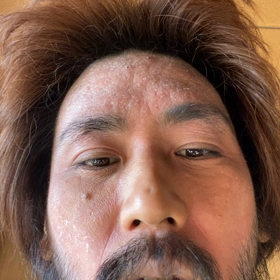 BisHアナスト犯訴えの画像