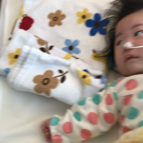 発作記事のアクセス数の画像