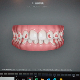開始32日目 #7の画像