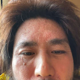 HYDE犯罪ばれの画像