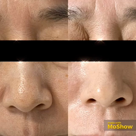 一生物の美肌を手に入れるプログラムの画像