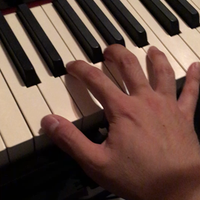 リハビリの画像