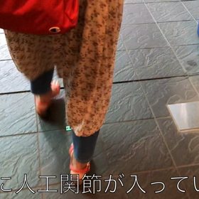 人工関節の歩行動画パート2の画像