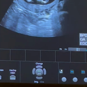 12w3d 眠い…の画像