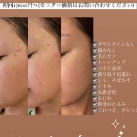 残りお一人様　モニター募集中ですの画像