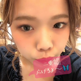 二重幅の広げ方♡の画像