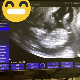 妊婦健診②③の画像