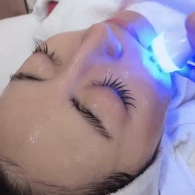 エレクトロポレーションについて。の画像