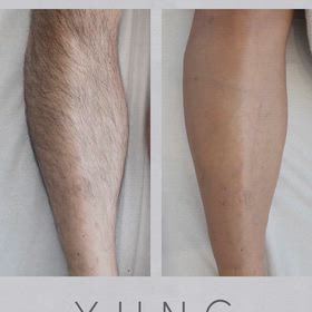 今年も短パン無理そう？の画像