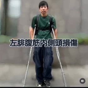 左腓腹筋内側頭損傷の画像