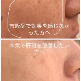 肝斑専門店の画像