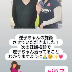 逆子の施術の画像