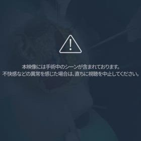 顔面リフティングの画像