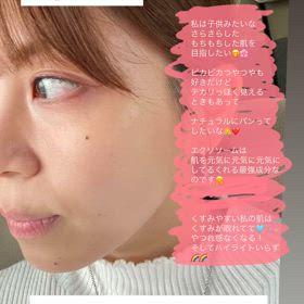 いま話題の再生エクソソーム！/浜松市　シミたるみケアの画像