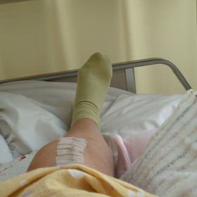 人工膝関節置換術～➀入院24日目の画像