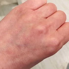 第三話 : 手のひらから金粉が噴き出てきた日の画像