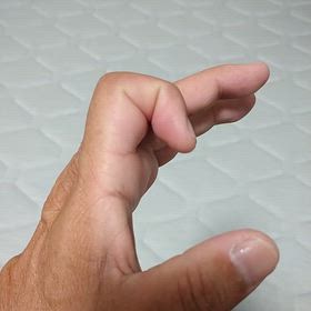 突き指はリハビリ継続ですの画像