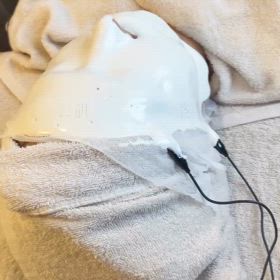 本気の肌質改善『エンビロン』の画像