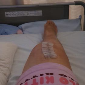 人工膝関節置換術～➂入院15日目の画像