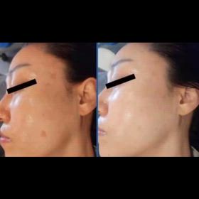 韓国最先端！ダクトピールの画像