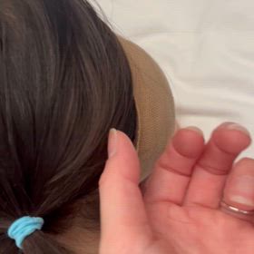 退院前日の画像