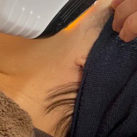 光フォト★宇治　城陽　肌再生・肌質改善　肝斑　そばかすの画像