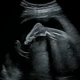 5.7(火) 妊婦検診24w6dの画像