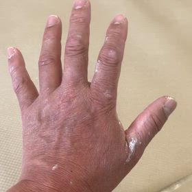 不幸自慢男子の画像