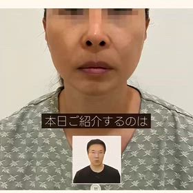 シワのない美しいフェイスラインに変身✨の画像