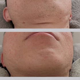 ライバルに教えたくない清潔感課金の画像